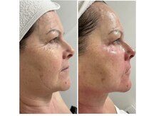 ティーボックスボーテ(TBOX beaute)/