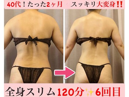 マール(Mar)の写真