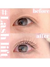 カナン(kanan)/before after