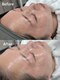 リボンドケー(Rebond-K)の写真/韓国発の次世代ピーリングで、つるんと輝く水光肌へ。毛穴・くすみ・キメを整え、素肌に自信を。