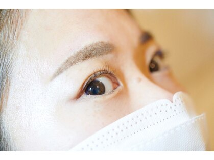 ラディユー(Radieux)の写真