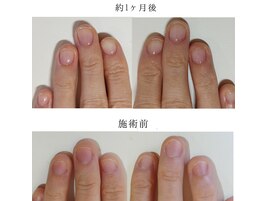 自爪育成コース