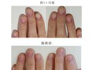 自爪育成コース
