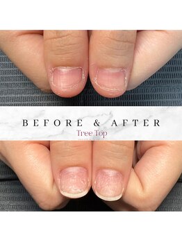 深爪育成メニュー