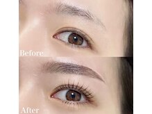 レピア 高槻店/韓国式LEPIA Before&After