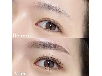 レピア 高槻店/韓国式LEPIA Before&After