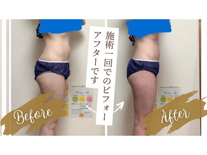 ヨサパーク クララ(YOSAPARK クララ)の写真