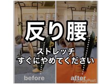 カワル整体 上通り院/毎日のストレッチが原因かも。