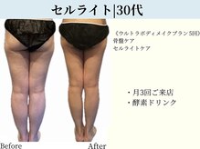 京都フォーエイチ(京都4H)/太もも・ふくらはぎ・足首集中