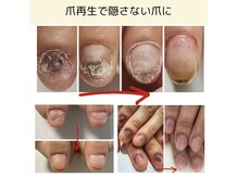 ネイルズシアム