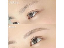 レピア 高槻店/韓国式LEPIA Before&After