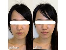 整え屋 レッド(RED)/阿波座/本町/小顔矯正/美容整体