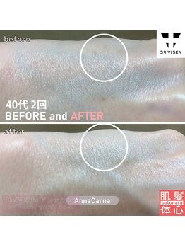 アンナカルナ(AnnaCarna)/回数を重ねれば結果が出る施術♪