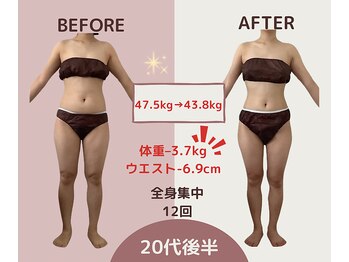 エテルナ(Eterna)/安城市　ダイエット　痩身