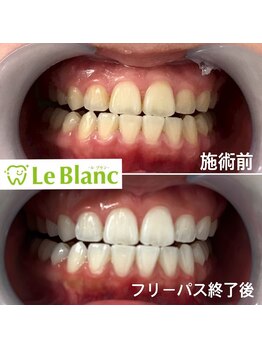 ルブラン 奈良店(Le Blanc)/3週間で手に入れる!