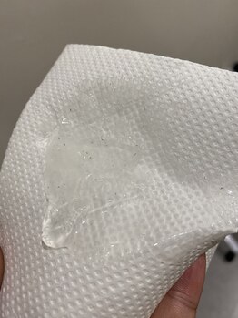 ワイズサロン(Y's salon)/ヒゲ脱毛で飛び出してきたヒゲ