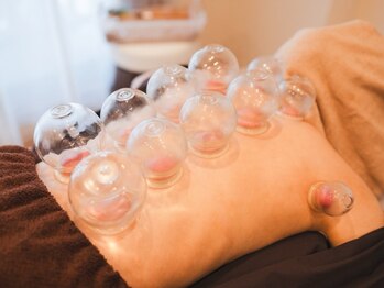 はり灸ソル(はり灸Sol)の写真/【神戸三宮 女性専用鍼灸院】美容鍼＋全身施術でたるみ改善＆疲労回復ケア