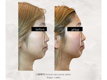 エスポワールカルド(Espoir caldo)/