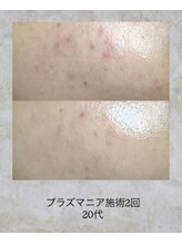 コンクパール(CONCH PEARL.)/プラズマニア