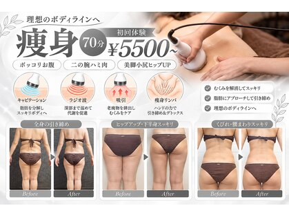 ラクラク(rakuraku)の写真