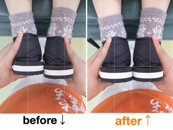 健康工房たいよう整骨院/骨盤矯正後の脚長差