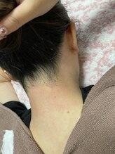 ルナベイビー(Luna Baby)/うなじワックスAFTER