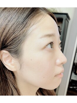 トランジットケイ(TRANSIT K)/まつげパーマ