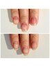 【HAND/クリア】初めての育成ネイル☆ケアオイル付き♪￥12000→￥10000