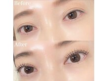 レピア 高槻店/韓国式LEPIA Before&After