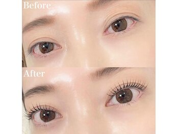 レピア 高槻店/韓国式LEPIA Before&After