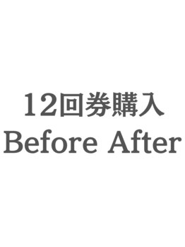 ホワイトニングカフェ 守山店/