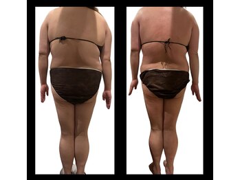 ルブルジョン(le bourgeon)/現在のモニター様進捗