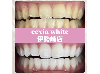 エクシア ホワイトニング 伊勢崎店の写真