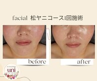 パーソナル ユニ(uni)