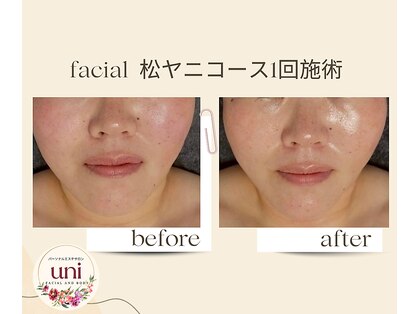 パーソナル ユニ(uni)の写真