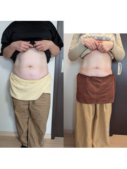 リルーチェ 倉敷(Riluce)/ぽっこりお腹撃退