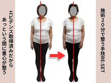 ロウズィエト(Roseate)