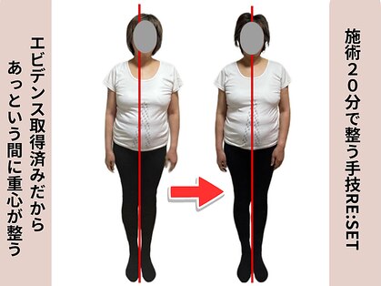 ロウズィエト(Roseate)の写真