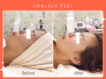 シロカネ イオンタウン西熊本店(SHIROKANE)/ララピール☆