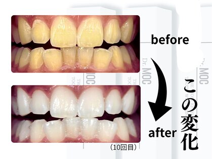 ティアラ 高岡店(Tiara)の写真