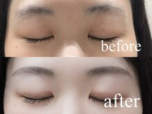 シエナ アイ(CIENA eye)/