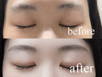 シエナ アイ(CIENA eye)/