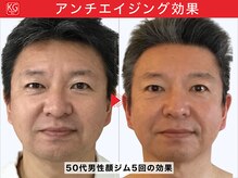 顔ジム 麻布店/50代男性顔ジム継続の効果