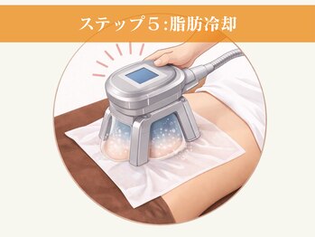 LUTINA【ルティナ】痩身/脂肪冷却/キャビテーション/ラジオ波【4月上旬OPEN(予定)】/脂肪冷却でピンポイントケア