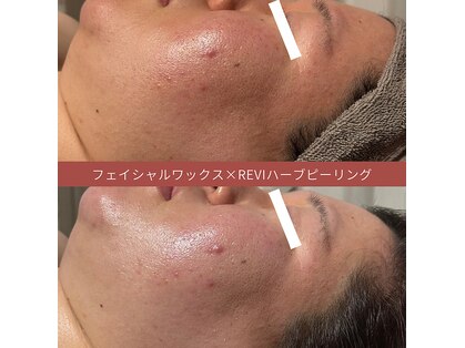 エステ リラクゼーションサロン(more)の写真