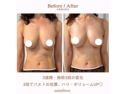 ミミバスト(mimibust)の写真