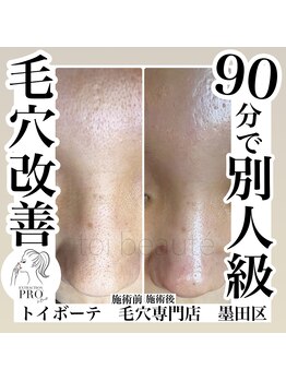 トイボーテ(toi beaute)/たった一回で納得の効果効果！！