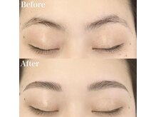 レピア 高槻店/韓国式LEPIA Before&After