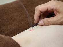 ティルナノーグイリニ(Tir Na Nog-EIRINI)/巡り、整う。八分灸の時間