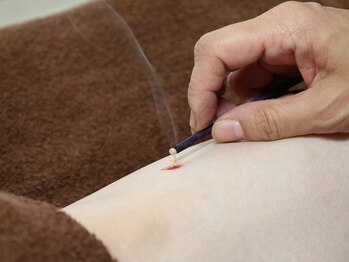 ティルナノーグイリニ(Tir Na Nog-EIRINI)/巡り、整う。八分灸の時間